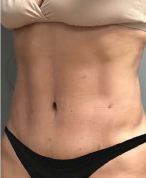 After Image
